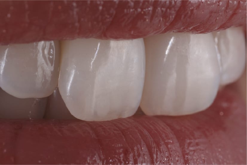 estetica-dental