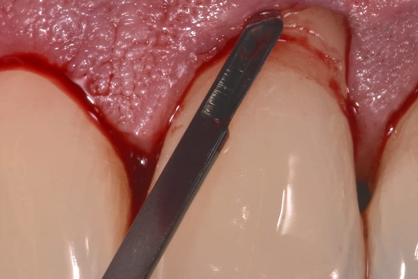 cirugía dental oviedo